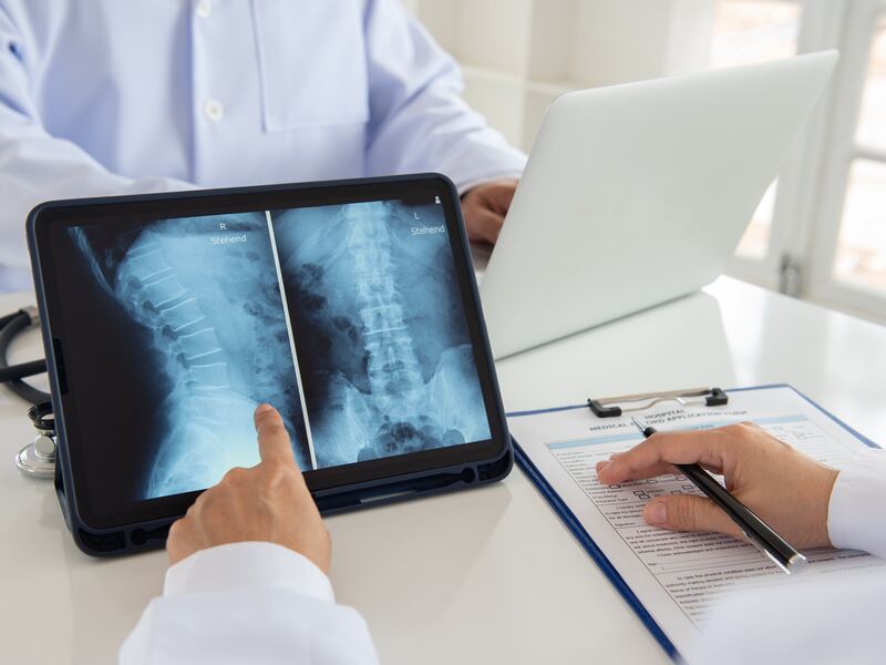 Spinal Cord Injury Lawyer Toronto